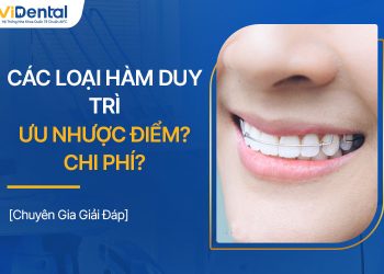 Các Loại Hàm Duy Trì: Ưu Nhược Điểm, Giá Thành, Lưu Ý