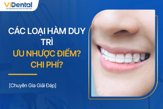 Các Loại Hàm Duy Trì: Ưu Nhược Điểm, Giá Thành, Lưu Ý