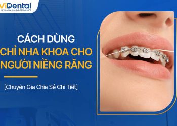 Cách Dùng Chỉ Nha Khoa Khi Niềng Răng Chuyên Gia Chia Sẻ