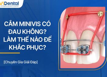 Cắm Minivis Có Đau Không? Làm Thế Nào Để Khắc Phục?