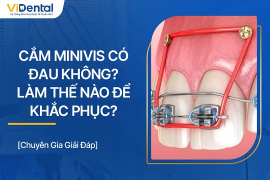 Cắm Minivis Có Đau Không? Làm Thế Nào Để Khắc Phục?