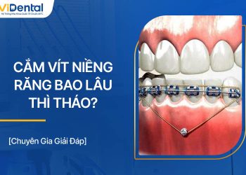 Cắm Vít Niềng Răng Bao Lâu Thì Tháo? Cắm Lâu Có Sao Không?