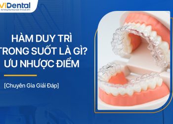 Hàm Duy Trì Trong Suốt Là Gì? Ưu Nhược Điểm, Giá Thành