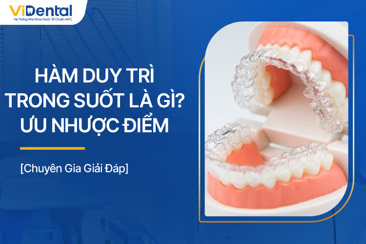 Hàm Duy Trì Trong Suốt Là Gì? Ưu Nhược Điểm, Giá Thành