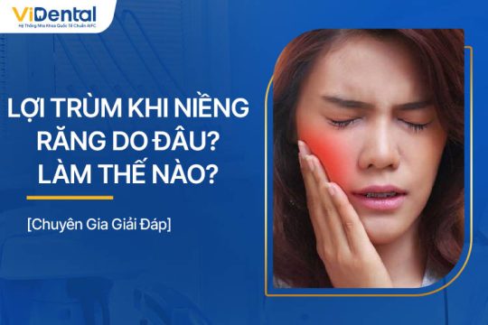 Lợi Trùm Khi Niềng Răng Do Đâu? Làm Thế Nào Để Xử Lý?