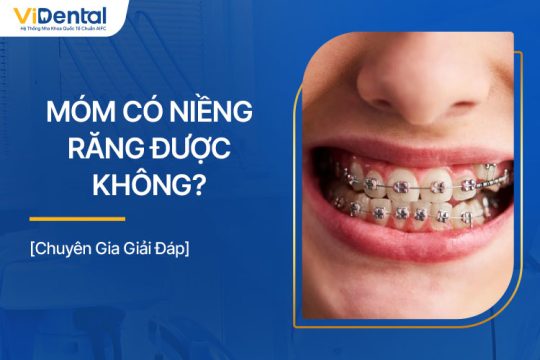 Bị Móm Có Niềng Răng Được Không? Chuyên Gia Chia Sẻ 