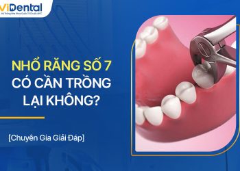 Nhổ Răng Số 7 Có Cần Trồng Lại? Chọn Phương Pháp Nào?