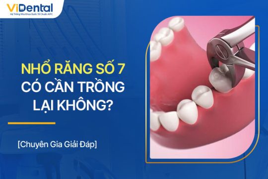 Nhổ Răng Số 7 Có Cần Trồng Lại? Chọn Phương Pháp Nào?