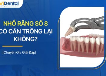 Nhổ Răng Số 8 Có Cần Trồng Lại Không? Chuyên Gia Giải Đáp