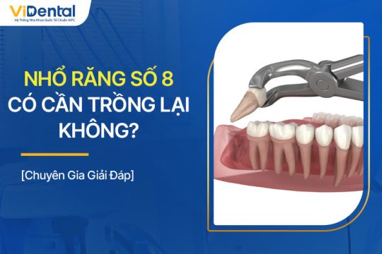 Nhổ Răng Số 8 Có Cần Trồng Lại Không? Chuyên Gia Giải Đáp