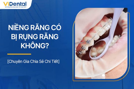 Niềng Răng Có Bị Rụng Răng Không? Cần Lưu Ý Gì?