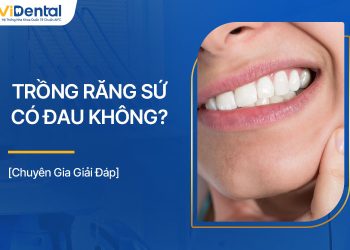 Trồng Răng Sứ Có Đau Không? Giải Đáp Chi Tiết Từ Chuyên Gia