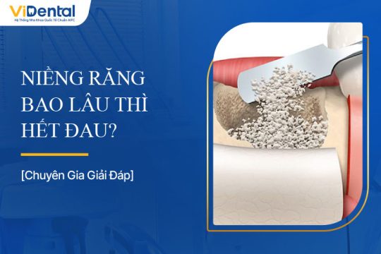 Chi Phí Ghép Xương Implant Là Bao Nhiêu? Bảng Giá Cụ Thể