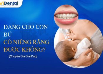 Giải Đáp: Đang Cho Con Bú Có Niềng Răng Được Không?