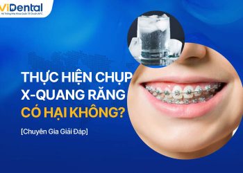 Niềng Răng Có Nên Uống Nước Lạnh Không? [Giải Đáp]