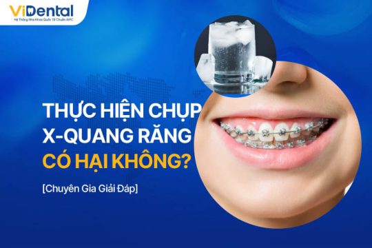 Niềng Răng Có Nên Uống Nước Lạnh Không? [Giải Đáp]