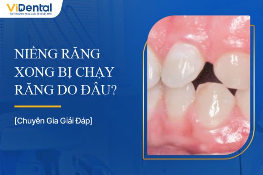 Niềng Răng Xong Bị Chạy Răng Phải Làm Sao?