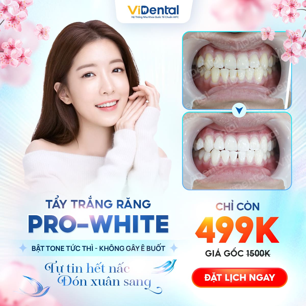 Tẩy trắng răng Pro-White chỉ 499k