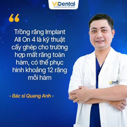 trong-rang-implant-all-on-4-1.jpg