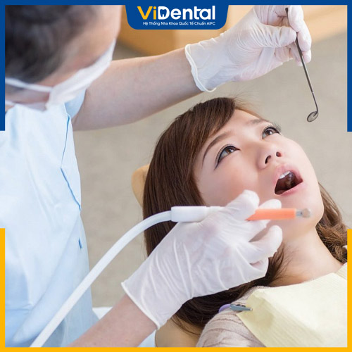 Nên đến nha khoa để lấy cao răng tại nhà