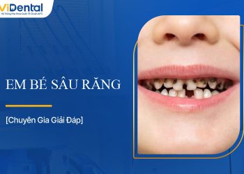 Em Bé Sâu Răng: Nguyên Nhân, Dấu Hiệu Và Cách Phòng Ngừa