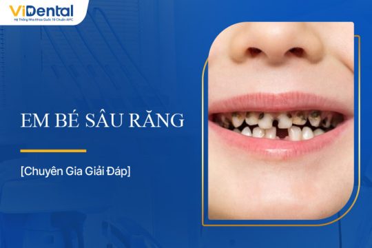 Em Bé Sâu Răng: Nguyên Nhân, Dấu Hiệu Và Cách Phòng Ngừa