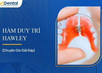 Hàm Duy Trì Hawley Là Gì? Tìm Hiểu Thông Tin Chi Tiết
