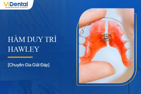 Hàm Duy Trì Hawley Là Gì? Tìm Hiểu Thông Tin Chi Tiết