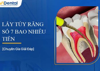 Lấy Tủy Răng Số 7 Bao Nhiêu Tiền? Giải Đáp Bảng Giá Chi Tiết