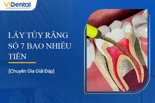 Lấy Tủy Răng Số 7 Bao Nhiêu Tiền? Giải Đáp Bảng Giá Chi Tiết