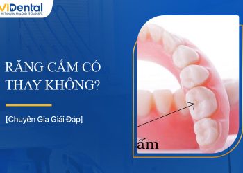 Răng Cấm Có Thay Không? Giải Đáp Chi Tiết Về Răng Cấm