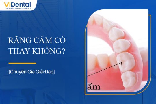 Răng Cấm Có Thay Không? Giải Đáp Chi Tiết Về Răng Cấm