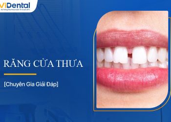 Răng Cửa Thưa: Nguyên Nhân, Tác Hại, Cách Khắc Phục