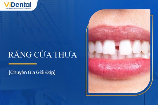 Răng Cửa Thưa: Nguyên Nhân, Tác Hại, Cách Khắc Phục