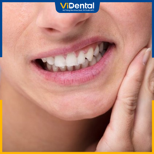 Mọc răng khôn thường gây đau nhức và sưng hàm