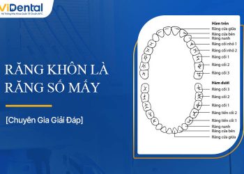 Răng Khôn Là Răng Số Mấy? Tìm Hiểu Chi Tiết Về Răng Khôn