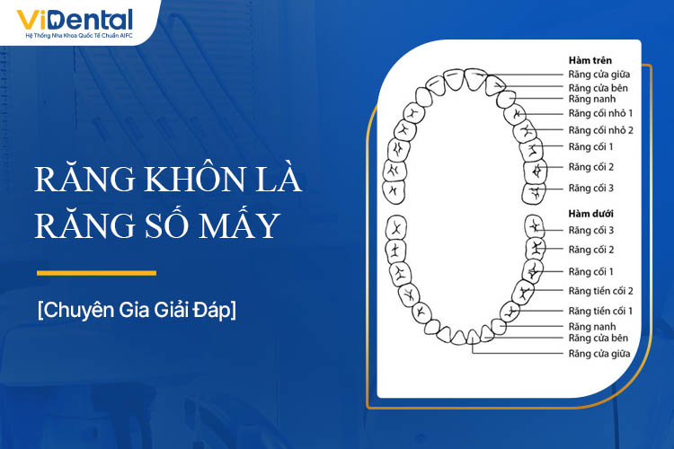 Răng Khôn Là Răng Số Mấy? Tìm Hiểu Chi Tiết Về Răng Khôn