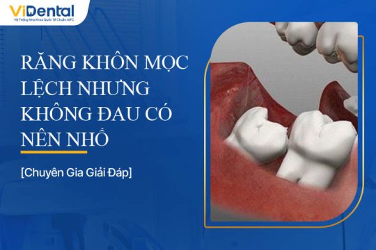 Răng Khôn Mọc Lệch Nhưng Không Đau Có Nên Nhổ?