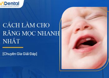 Cách Làm Cho Răng Mọc Nhanh Nhất Là Gì? Giải Đáp Chi Tiết