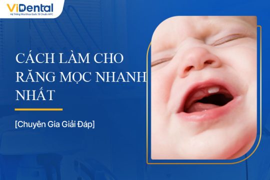 Cách Làm Cho Răng Mọc Nhanh Nhất Là Gì? Giải Đáp Chi Tiết