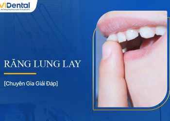 Răng Lung Lay: Nguyên Nhân và Dấu Hiệu Nhận Biết