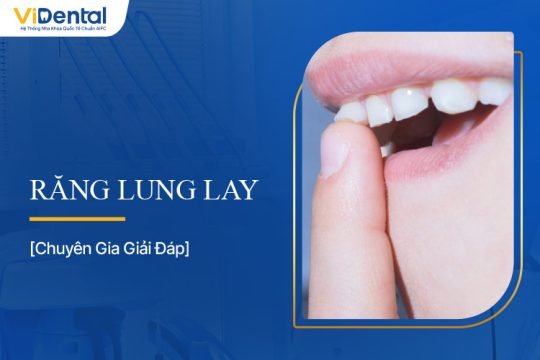 Răng Lung Lay: Nguyên Nhân và Dấu Hiệu Nhận Biết
