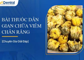 Top 10 Bài Thuốc Dân Gian Chữa Viêm Chân Răng Hiệu Quả
