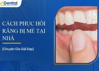 Cách Phục Hồi Răng Bị Mẻ Tại Nhà Hiệu Quả Nhất