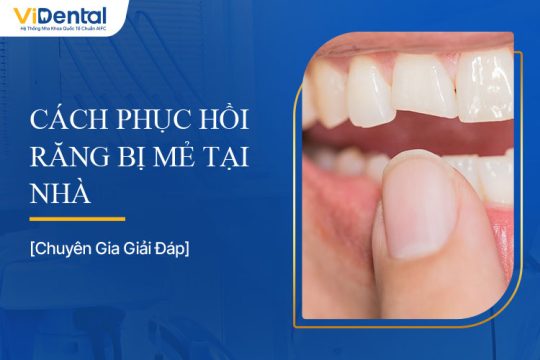Cách Phục Hồi Răng Bị Mẻ Tại Nhà Hiệu Quả Nhất