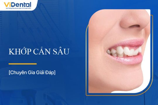 Khớp Cắn Sâu Là Gì? Làm Sao Để Cải Thiện Khớp Cắn?