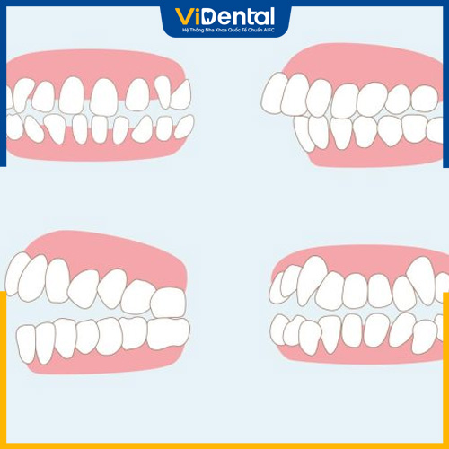 Nguyên nhân có thể do bệnh lý răng hàm mặt