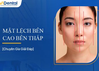 Mặt Lệch Bên Cao Bên Thấp: Nguyên Nhân và Dấu Hiệu