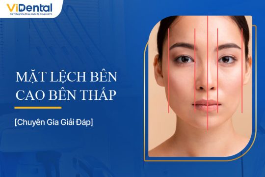 Mặt Lệch Bên Cao Bên Thấp: Nguyên Nhân và Dấu Hiệu