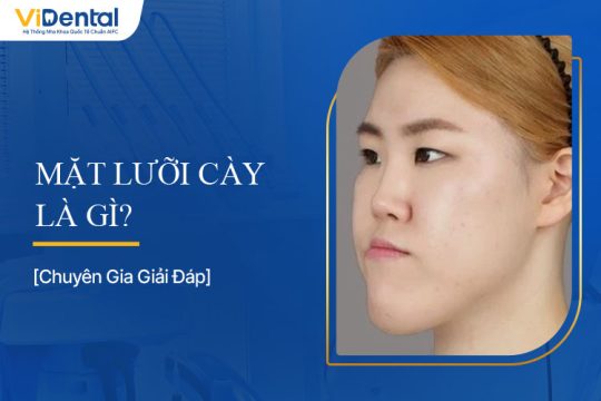 Mặt Lưỡi Cày Là Gì? Tìm Hiểu Chi Tiết - Nha Khoa ViDental